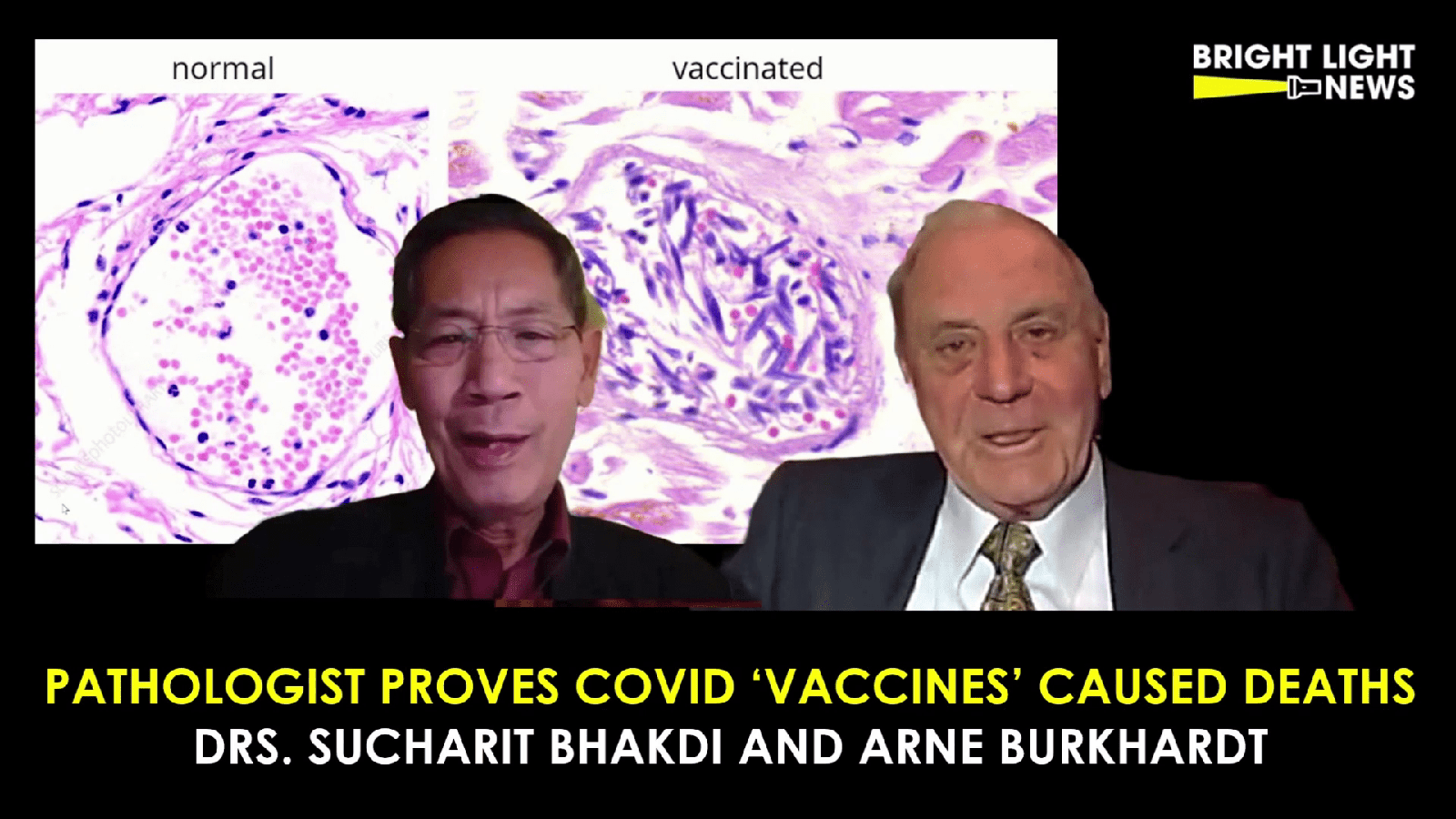 Pathologist Proves Covid ‘Vaccines’ Caused Deaths -Drs. Arne Burkhardt & Sucharit Bhakdi
